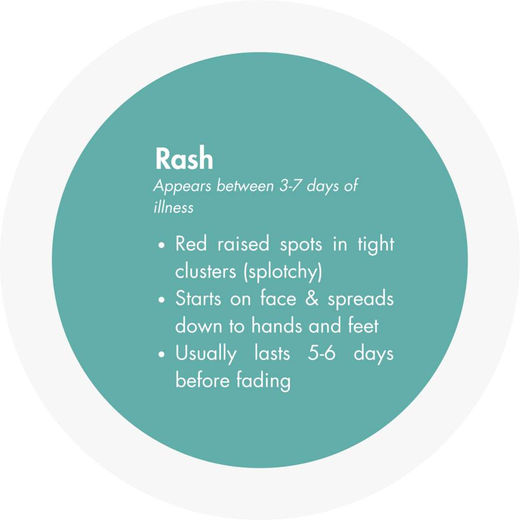 rash: appears between three to seven days of illness
Red raised spots in tight clusters (splotchy), starts on face and spreads down to hands and feet, usually lasts five to six days before fading