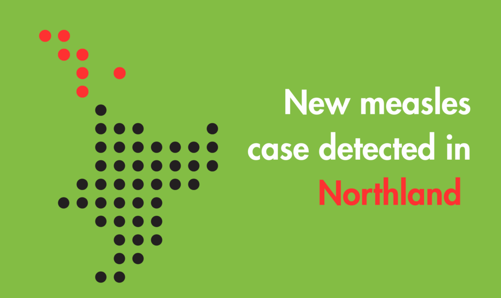 New measles case detected in northland 